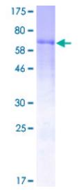 SDS-PAGE (F7-3622H).jpg